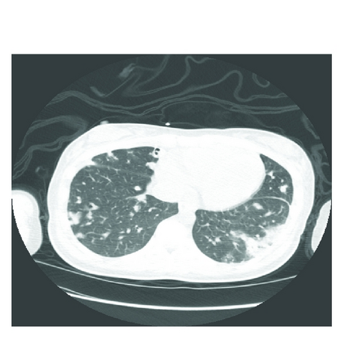 Details are in the caption following the image Details are in the caption following the image