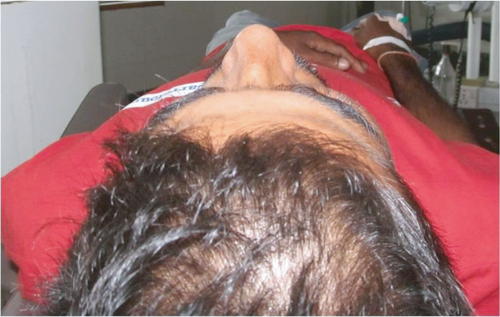 Details are in the caption following the image