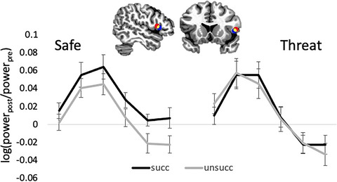 Anxious arousal alters prefrontal cortical control of stopping