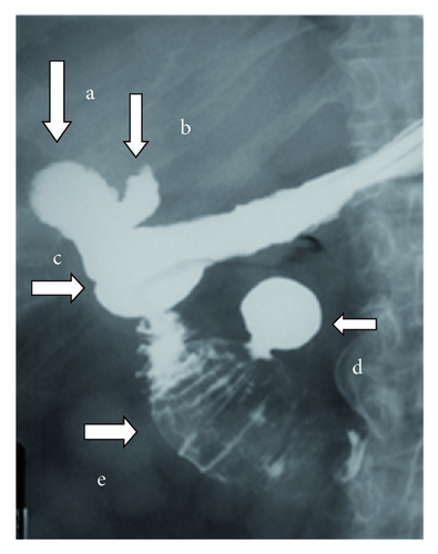 Details are in the caption following the image