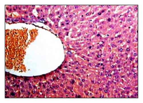 Details are in the caption following the image