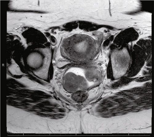 Details are in the caption following the image