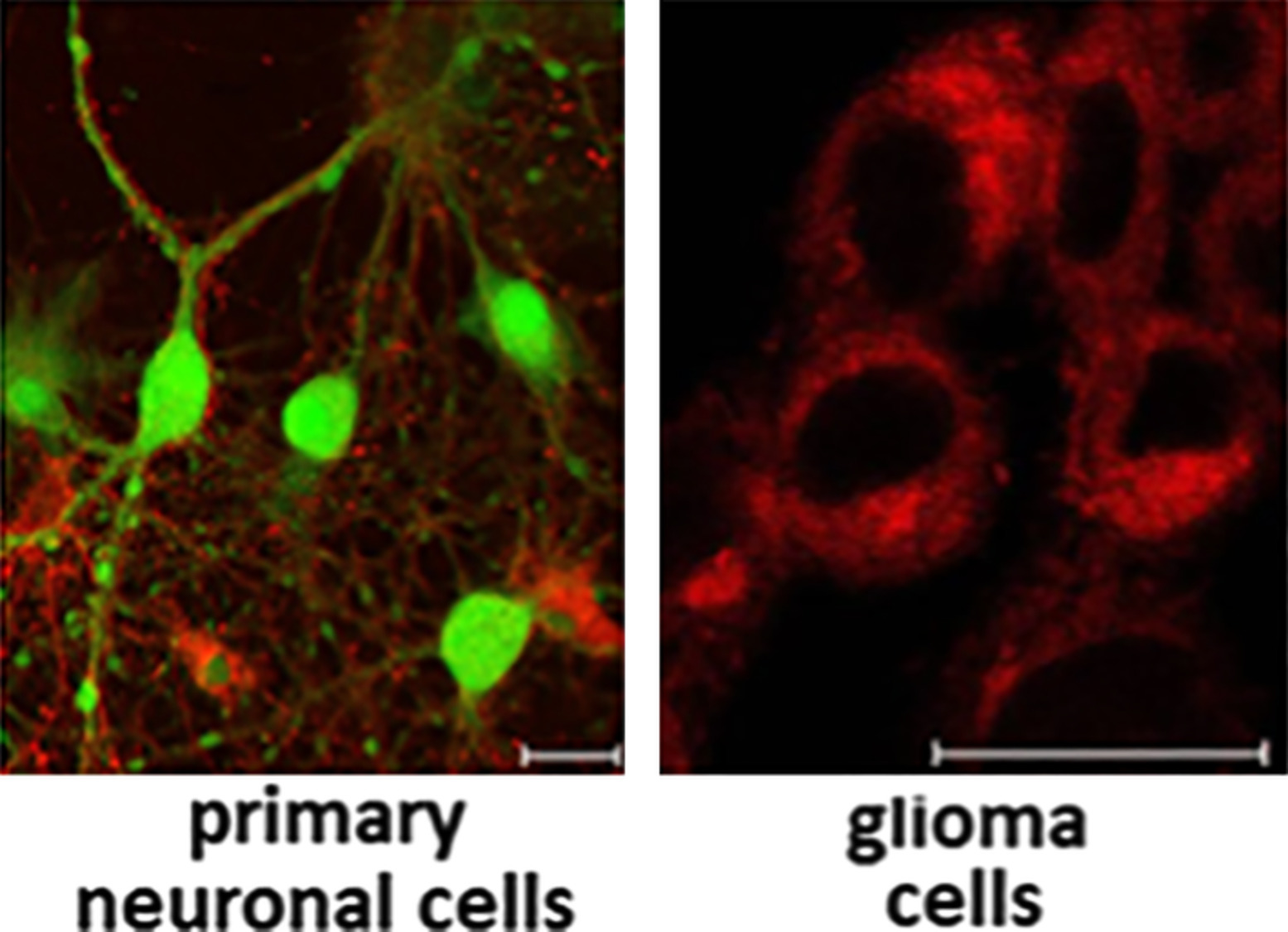 Effect of novel porphyrazine photosensitizers on normal and tumor brain cells