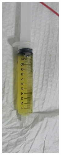 Details are in the caption following the image
