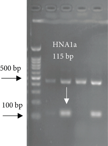 Details are in the caption following the image