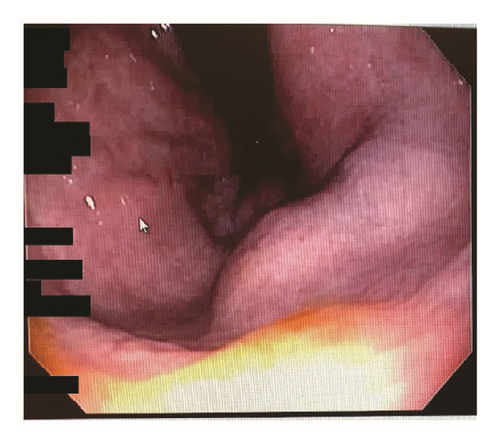 Details are in the caption following the image