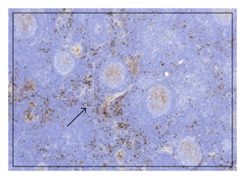 Details are in the caption following the image