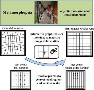 Measuring image distortions arising from age-related macular degeneration: An Iterative Amsler Grid (IAG)