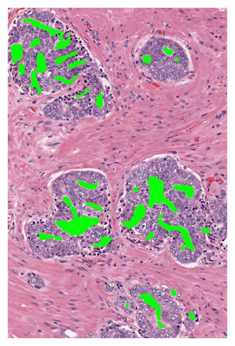 Details are in the caption following the image