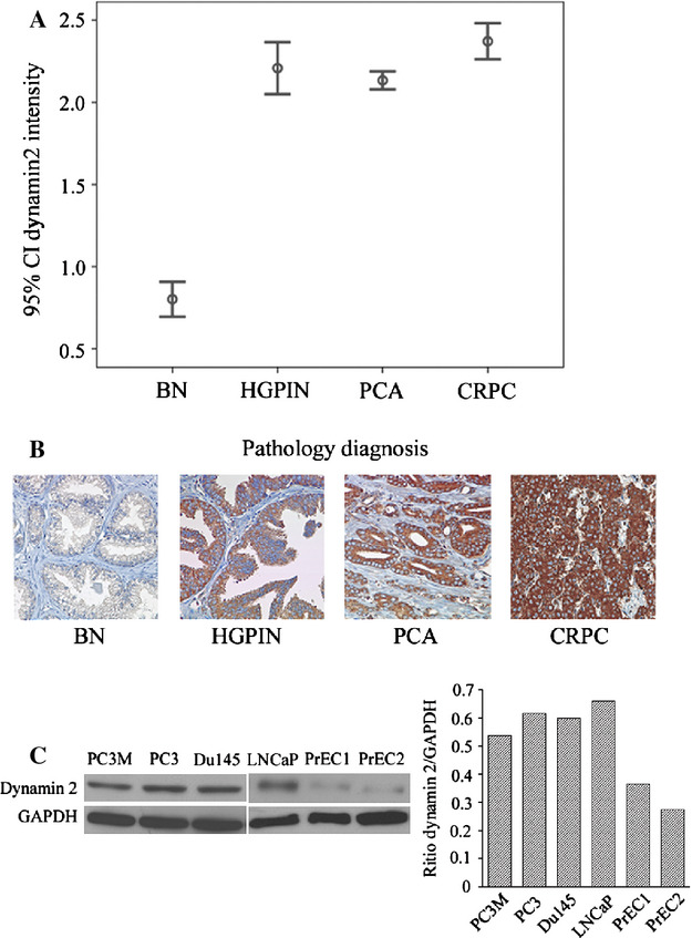 The significance of dynamin 2 expression for prostate cancer progression, prognostication, and therapeutic targeting