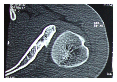 Details are in the caption following the image