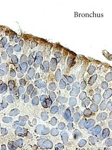 Details are in the caption following the image