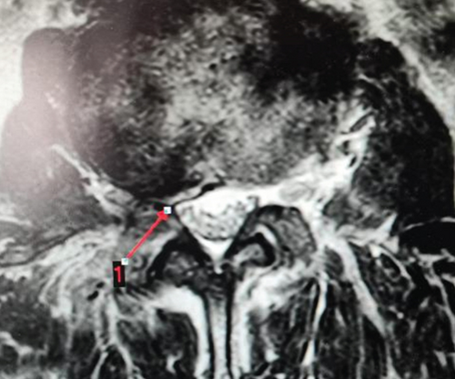 Details are in the caption following the image