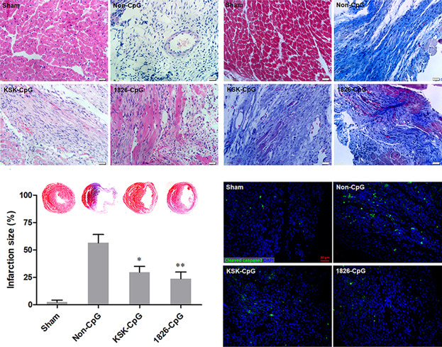 CpG oligodeoxynucleotide preconditioning improves cardiac function after myocardial infarction via modulation of energy metabolism and angiogenesis