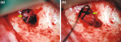 Details are in the caption following the image Details are in the caption following the image