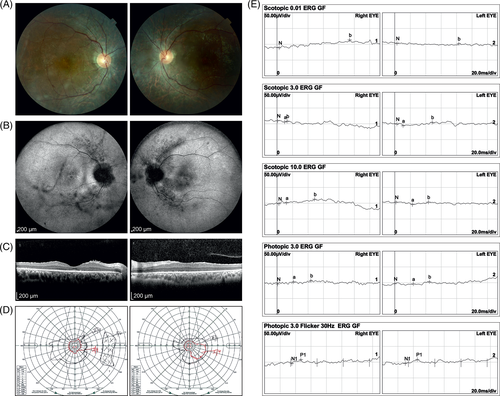 Details are in the caption following the image Details are in the caption following the image
