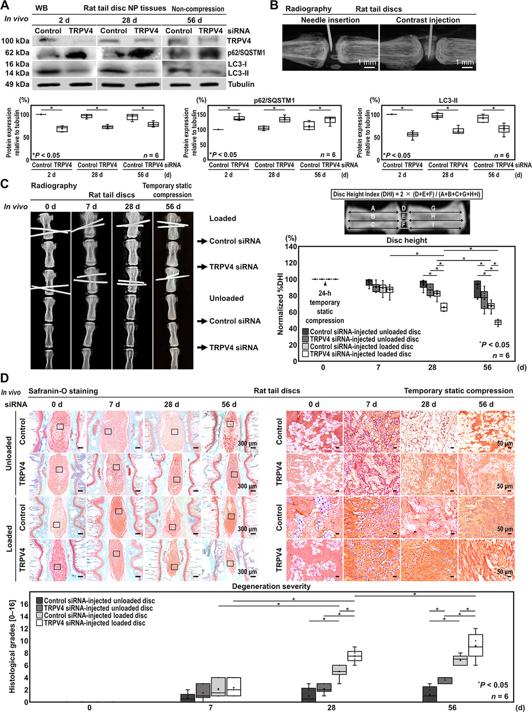 Transient Receptor Potential Vanilloid 4 Knockdown Decreases Extracellular Matrix Synthesis via Autophagy Suppression in the Rat Intervertebral Disc