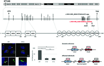 Whole-genome sequencing in patients with ciliopathies uncovers a novel recurrent tandem duplication in IFT140