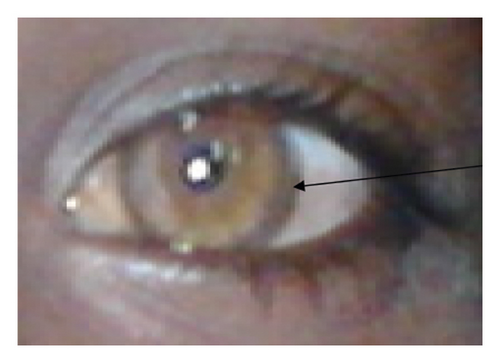 Details are in the caption following the image