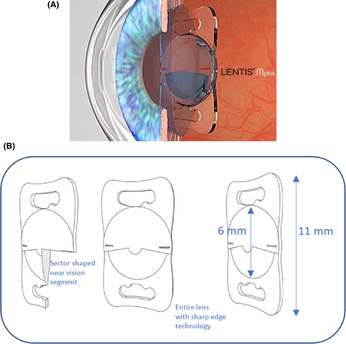 Details are in the caption following the image Details are in the caption following the image