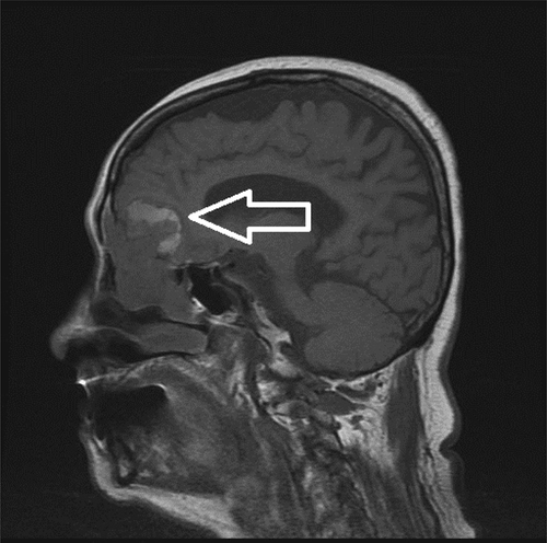 Details are in the caption following the image