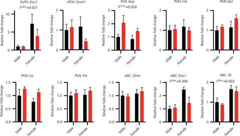 Impact of chronic variable stress on neuroendocrine hypothalamus and pituitary in male and female C57BL/6J mice