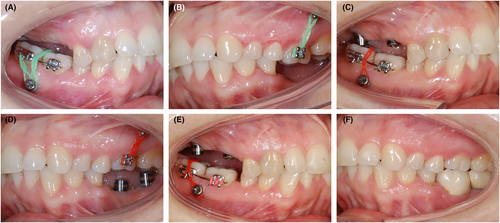 Details are in the caption following the image Details are in the caption following the image