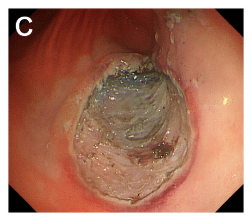 Details are in the caption following the image Details are in the caption following the image
