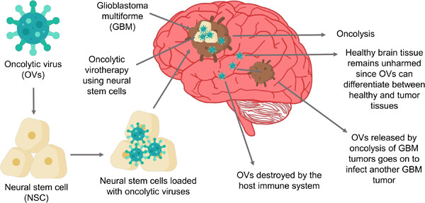 Oncolytic virotherapy using neural stem cells as a novel treatment option for glioblastoma multiforme