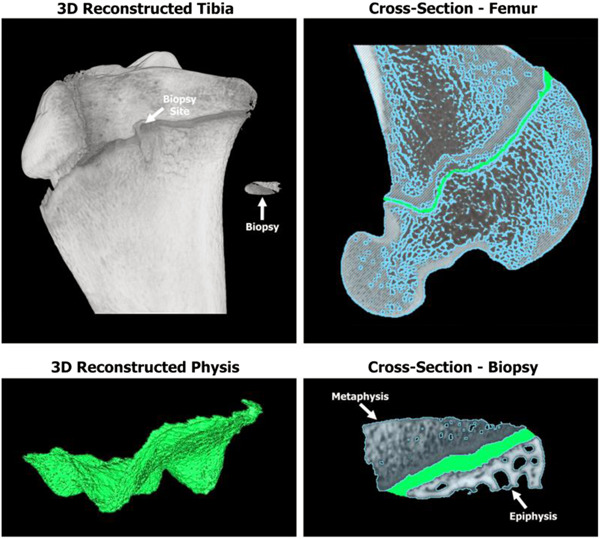 Assessing the safety of an epiphyseal plate biopsy in a translational lamb model
