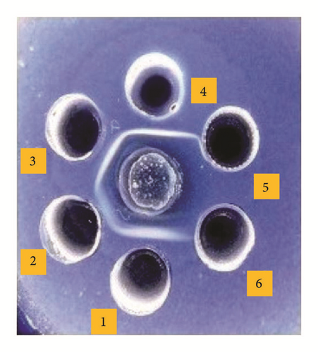 Details are in the caption following the image