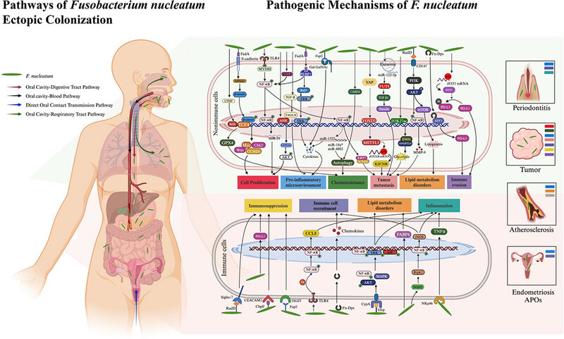 Unveiling the complex extra-oral colonization pathways and pathogenic mechanisms of Fusobacterium nucleatum, a heterogeneous oral pathogen