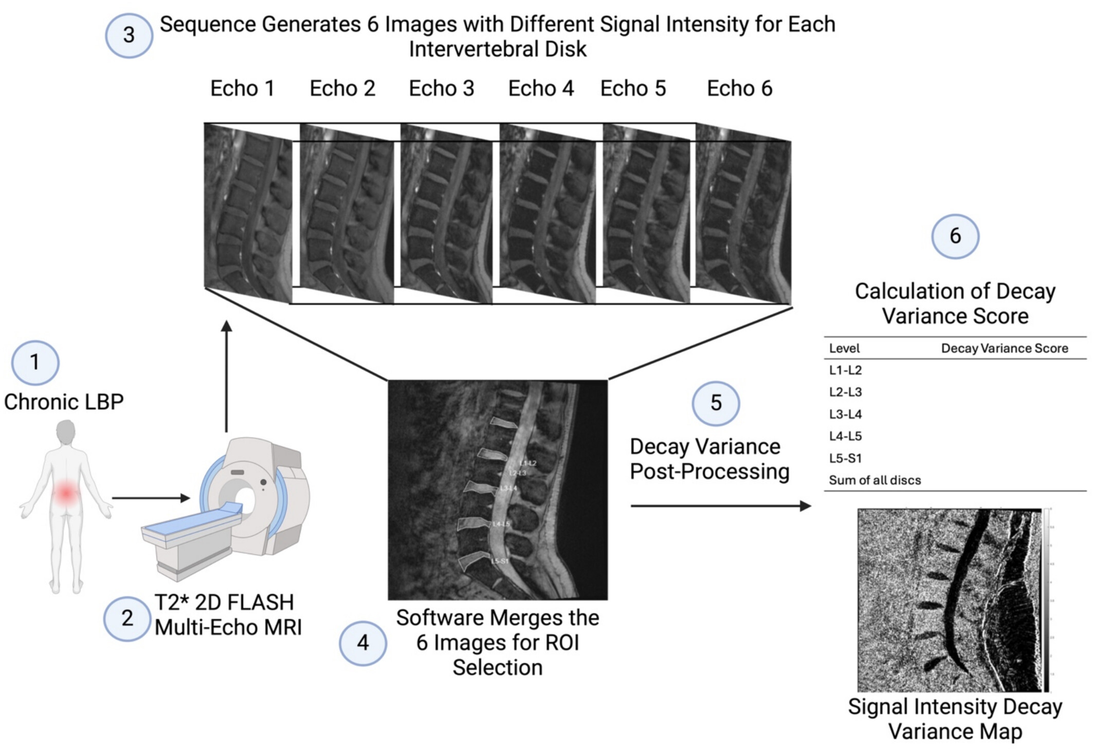 DeVa (Decay Variance): A Novel Score Calculated via Postprocessing the Changes in Signal Intensity of an Intervertebral Disc in a T2* Multi-Echo Magnetic Resonance Image Can Quantify Painful and Degenerate Lumbar Vertebral Discs