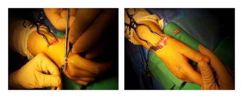 Details are in the caption following the image Details are in the caption following the image