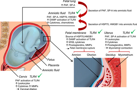 Targeting Toll-like receptor-4 to tackle preterm birth and fetal inflammatory injury