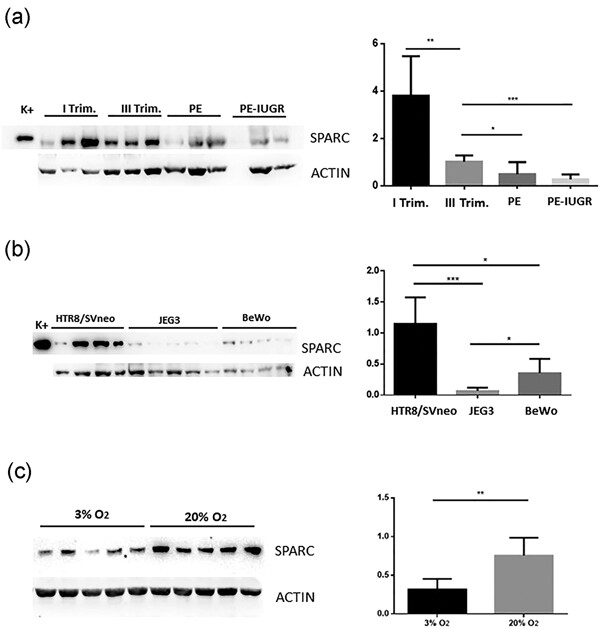 Pre-eclampsia onset and SPARC: A possible involvement in placenta development