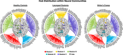The large-scale structural connectome of task-specific focal dystonia