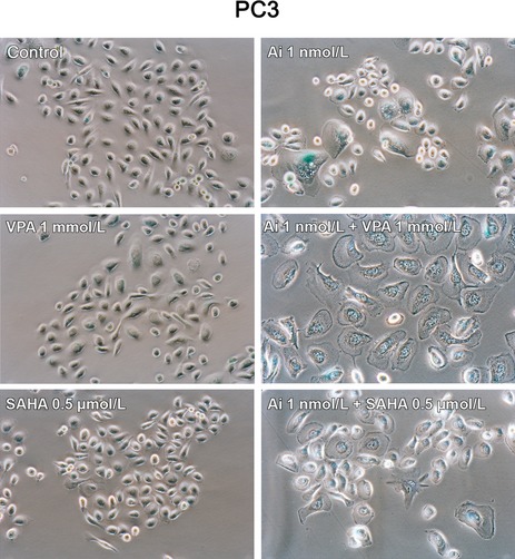 Combining the pan-aurora kinase inhibitor AMG 900 with histone deacetylase inhibitors enhances antitumor activity in prostate cancer