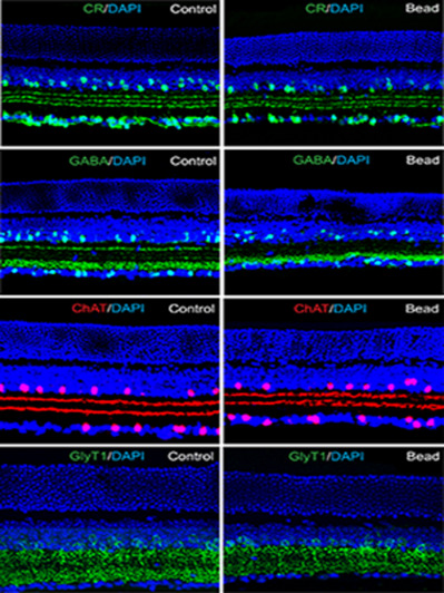 Amacrine cells coupled to ganglion cells via gap junctions are highly vulnerable in glaucomatous mouse retinas