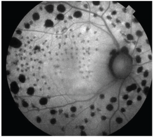 Details are in the caption following the image