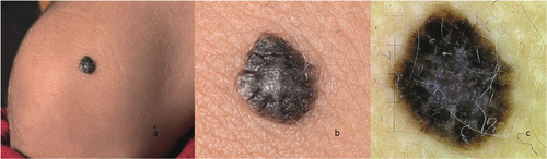 Details are in the caption following the image Details are in the caption following the image
