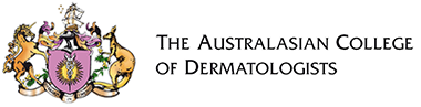 ACD