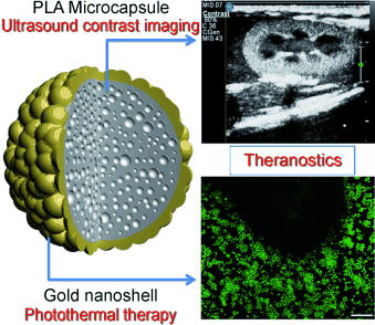 Double Strike To Fight Cancer - Combined diagnosis and treatment of tumors: photothermically activated ultrasound contrast agent