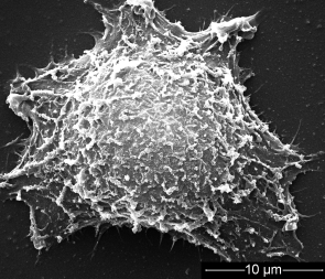 A New Coat for Golden Rods - New pretreatment process delivers biocompatible, stable gold nanorods for tumor treatment