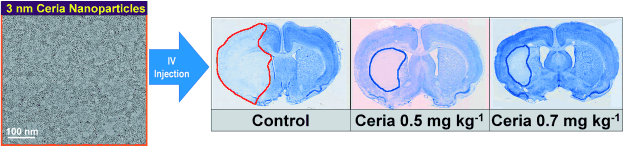New Treatment for Stroke? - Ceria nanoparticles could lessen the damage from ischemic strokes