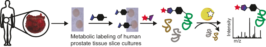 Glycans as Biomarkers for Cancer? - Bioorthogonal labeling of human prostate cancer tissue slice cultures to identify marker glycoproteins