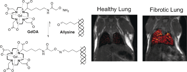 Imaging of Scar Tissue Formation - Noninvasive magnetic resonance imaging of lung fibrogenesis with an amino acid targeted probe