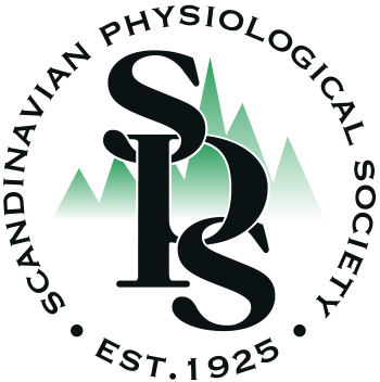 SPS