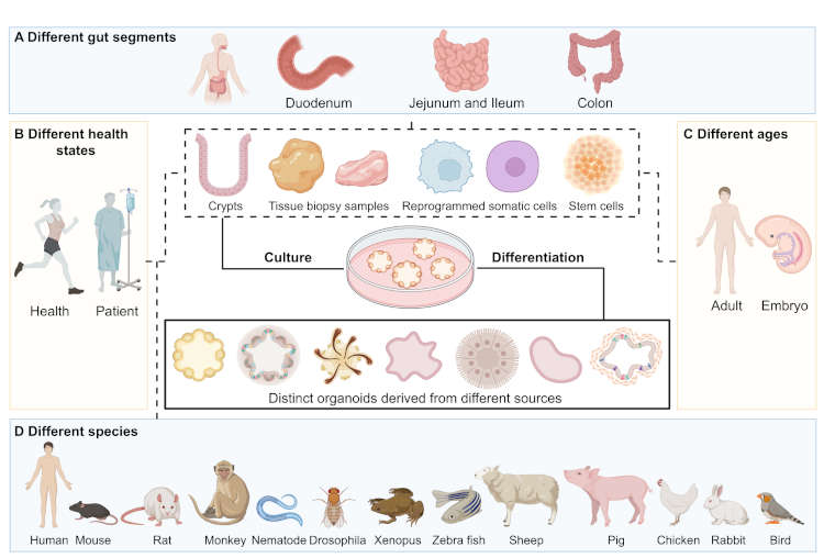 Organoids in gastrointestinal diseases: from bench to clinic