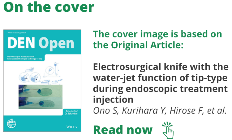 DEN Open Feature